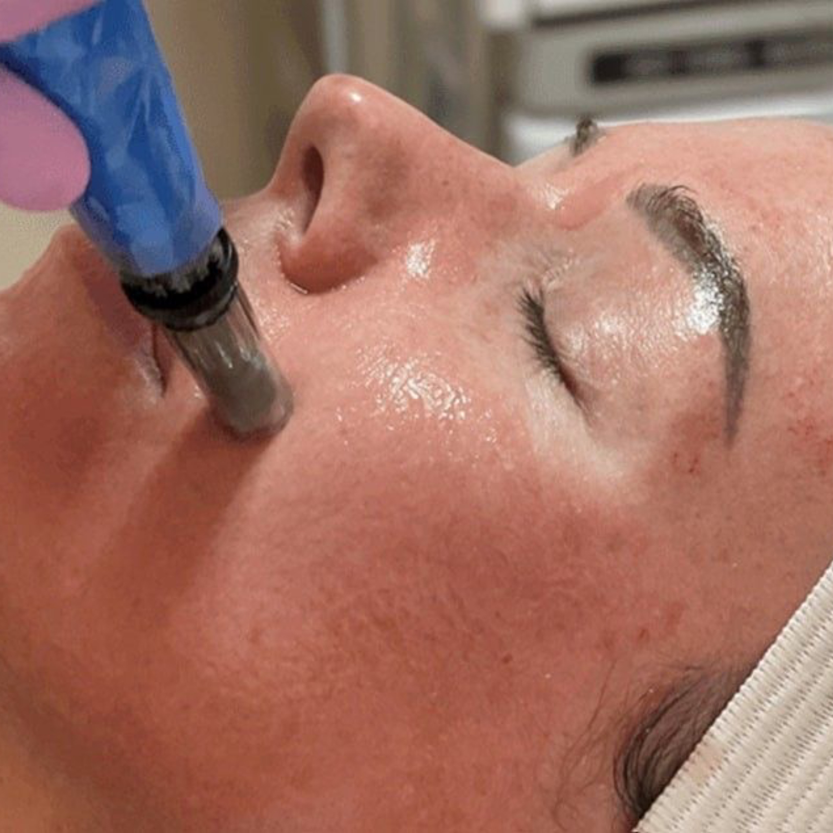 LIB-COSMETOLOGY - Hydrafacial (Close-up) [F7572]